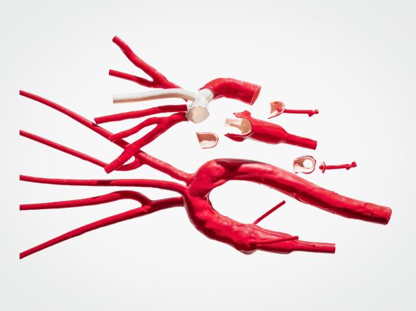 Aortic arch with aortic valve and supra-aortic vessels